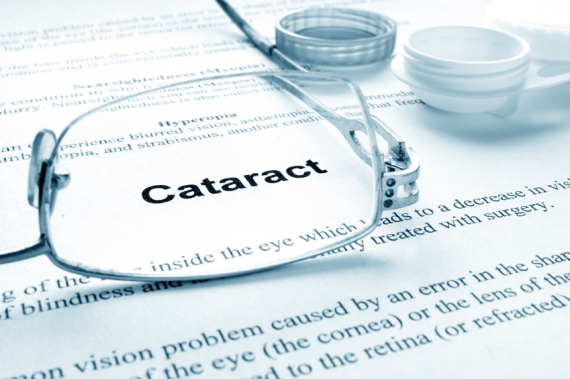 Cataract Doctor
