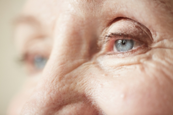 Facts about Eyelid Surgery