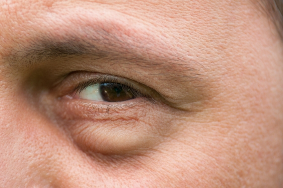 Best Eyelid Surgeons in Cape Coral, FL